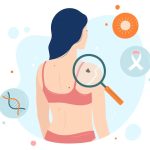 Ways to Prevent Skin Cancer