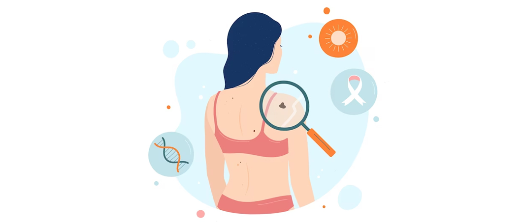 Ways to Prevent Skin Cancer
