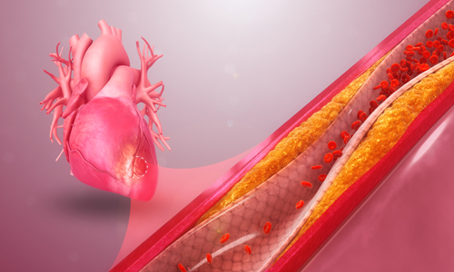 Support-Heart-Health