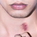 8 Ways to Grid of Hickies Almost Instantly