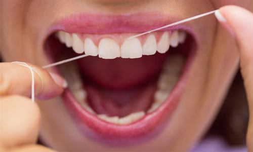 Poor Oral Hygiene