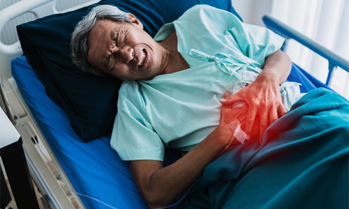 How Yeast Infections, Kidney Stones