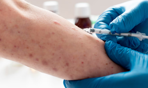 What-is-Measles