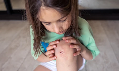 Cuts, Scrapes
