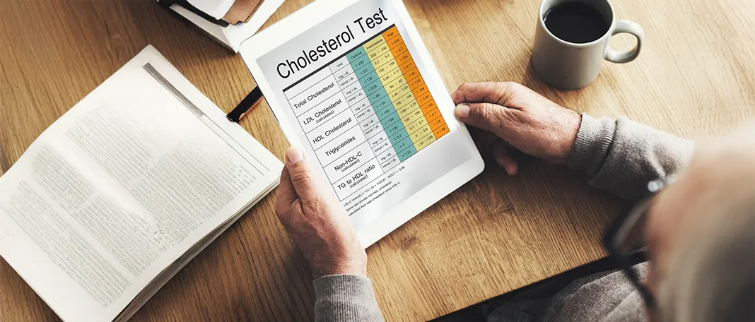 What Causes High Cholesterol: 7 Common Factors Revealed