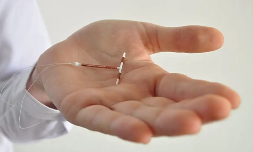 Intrauterine Devices