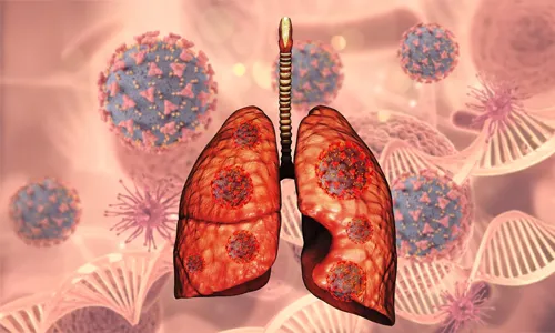 What Is the COPD