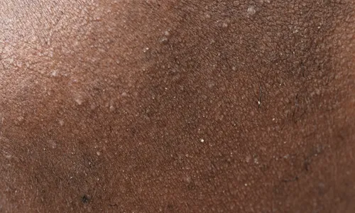 Harsh Sulfates