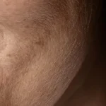 Ingredients That Dry Your Skin You Use Every Day