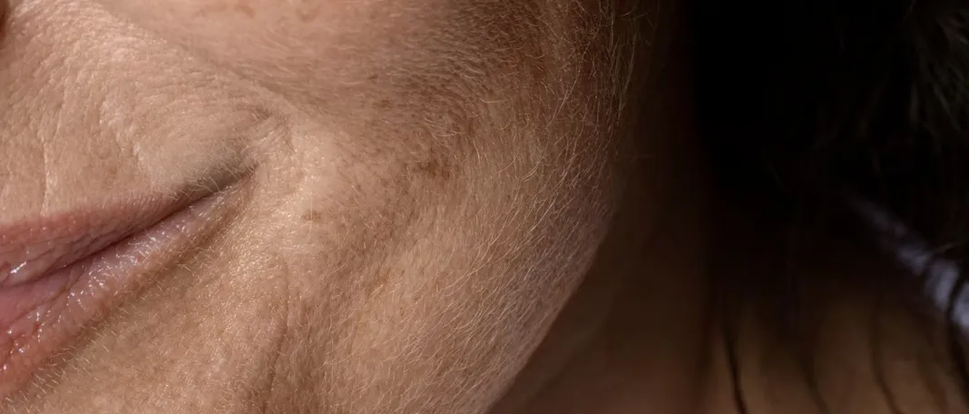 Ingredients That Dry Your Skin You Use Every Day