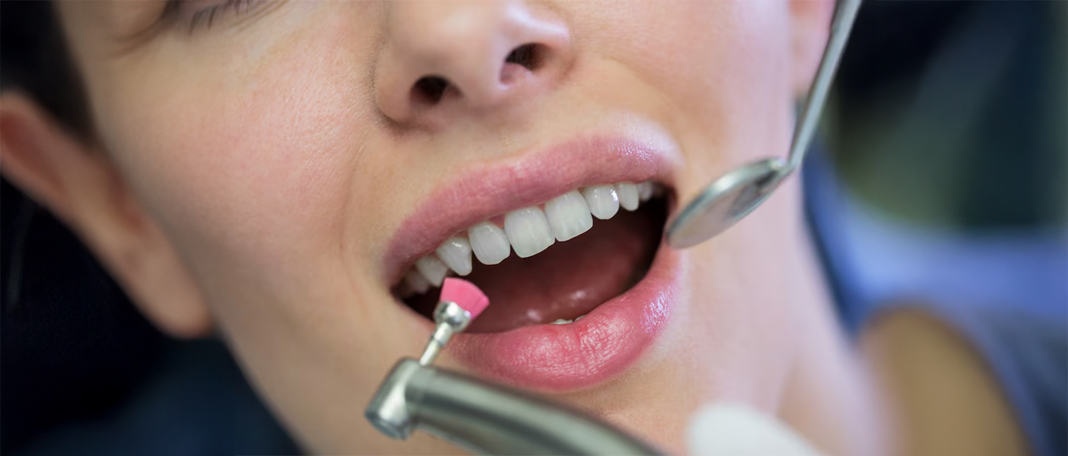 7 Everyday Habits That Ruin Your Teeth Enamel