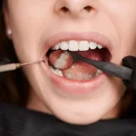 Causes for Toothache Beyond Cavities You Should Know