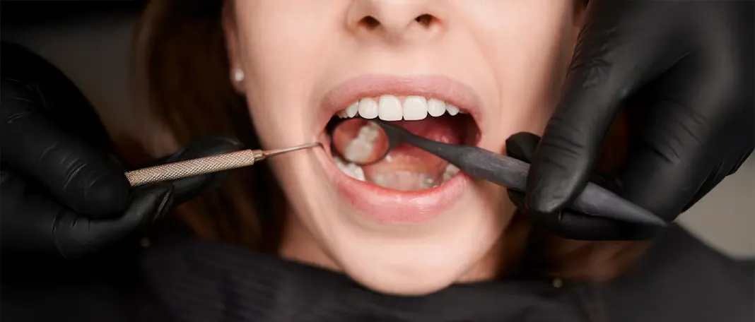 Causes for Toothache Beyond Cavities You Should Know