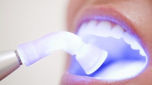 Over whitening your teeth