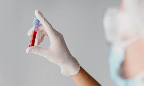 Blood-test