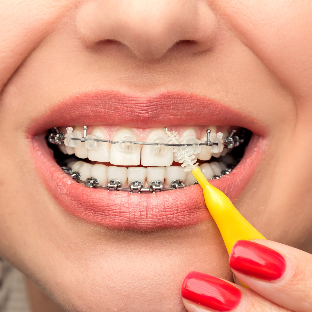 remove the remains stuck to your teeth