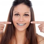 Types of braces and the right age to put them