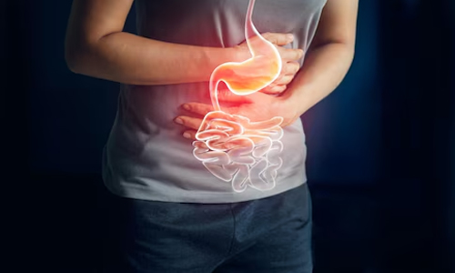 Acid reflux