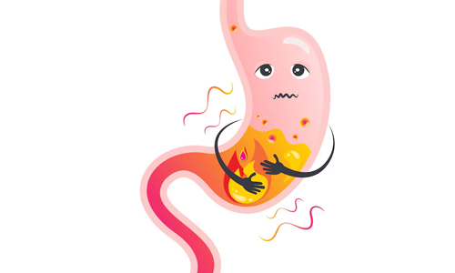 Indigestion