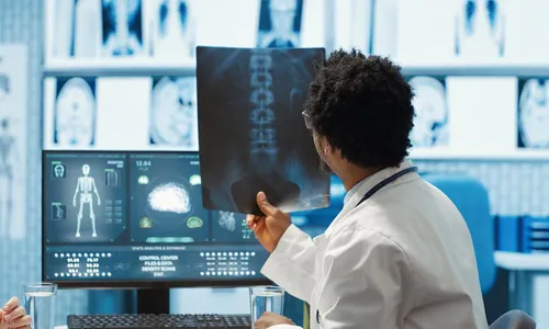 Do X-Rays1