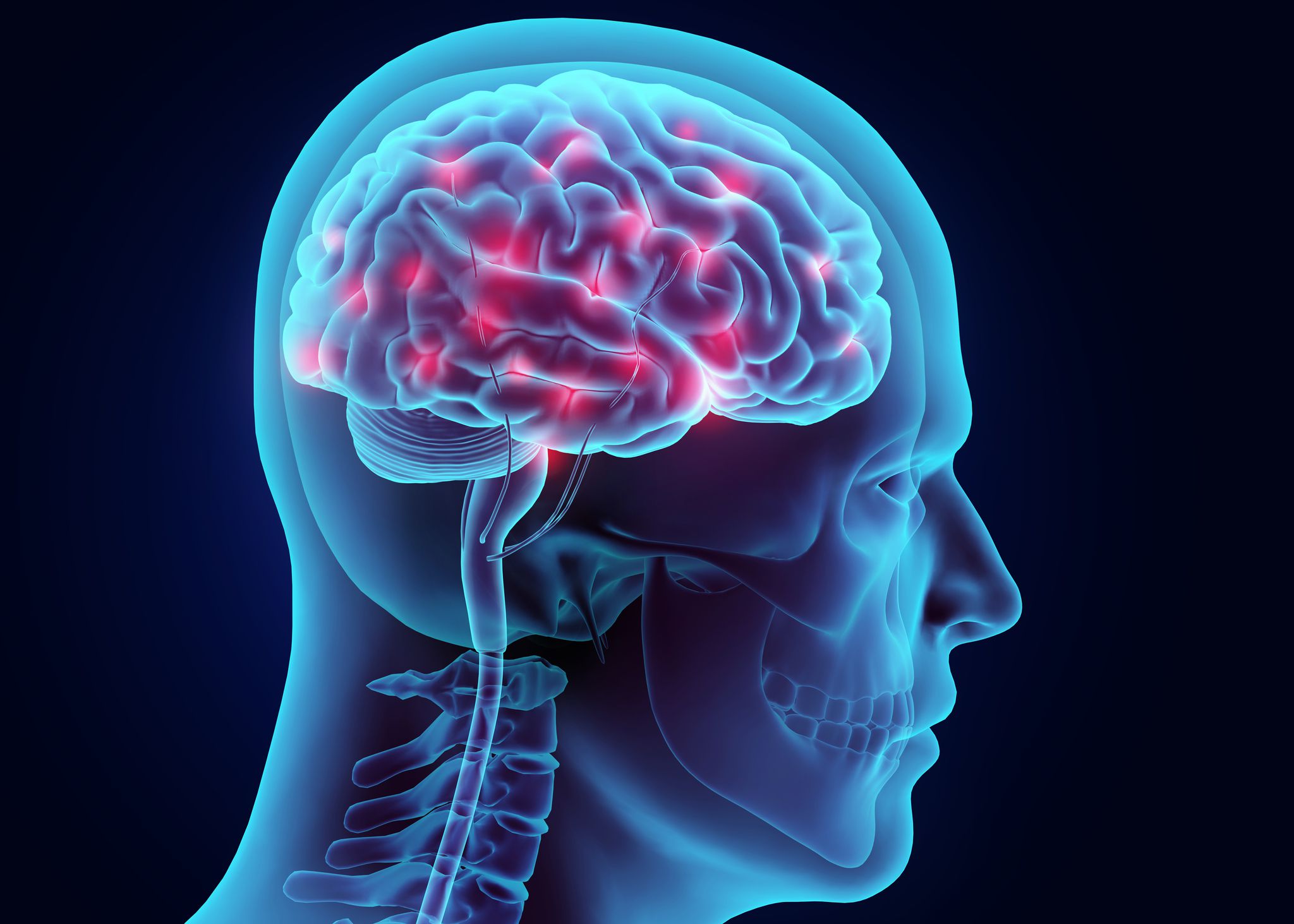 Obesity… The Casue Of Less Gray Matter Volume