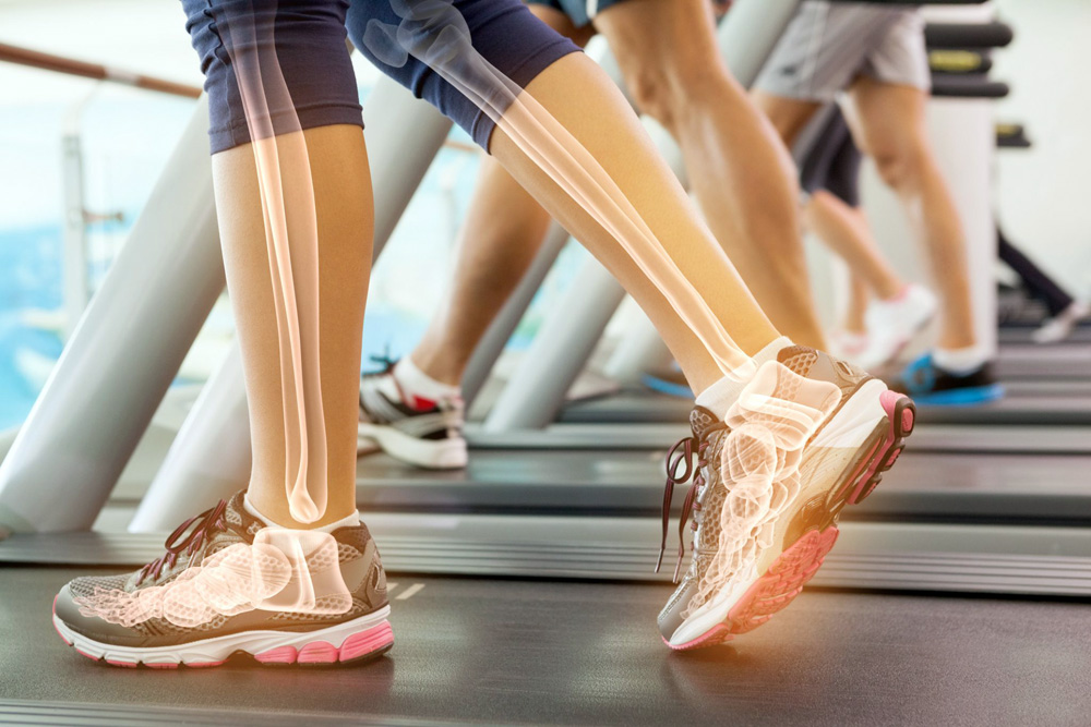 Low Bone Density Alert!