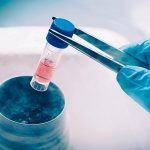 Does storing stem cells really help?