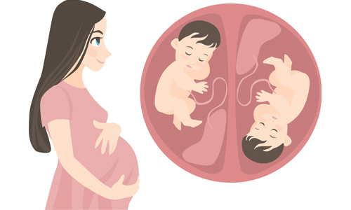 Multiple-Pregnancies