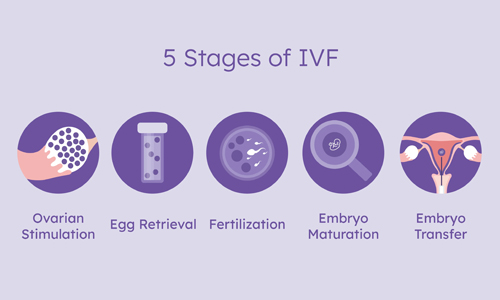 Stages-of-IVF