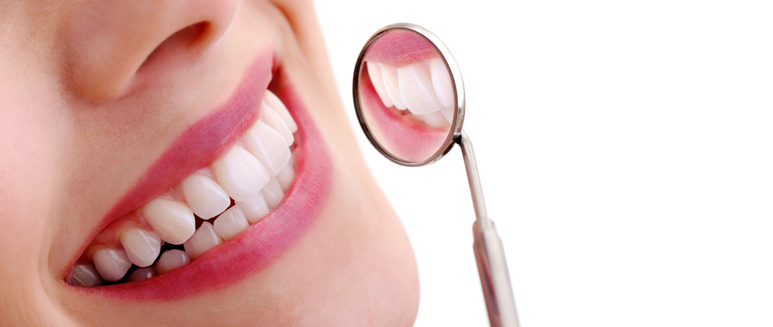 Remove Dental Plaque At Home Naturally   