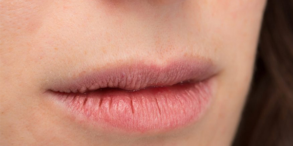 Heals Chapped Lips