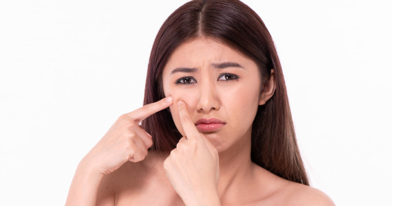 Acne and Scars