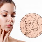 How to Deal with Dry Skin, Hair, Hands and Lips