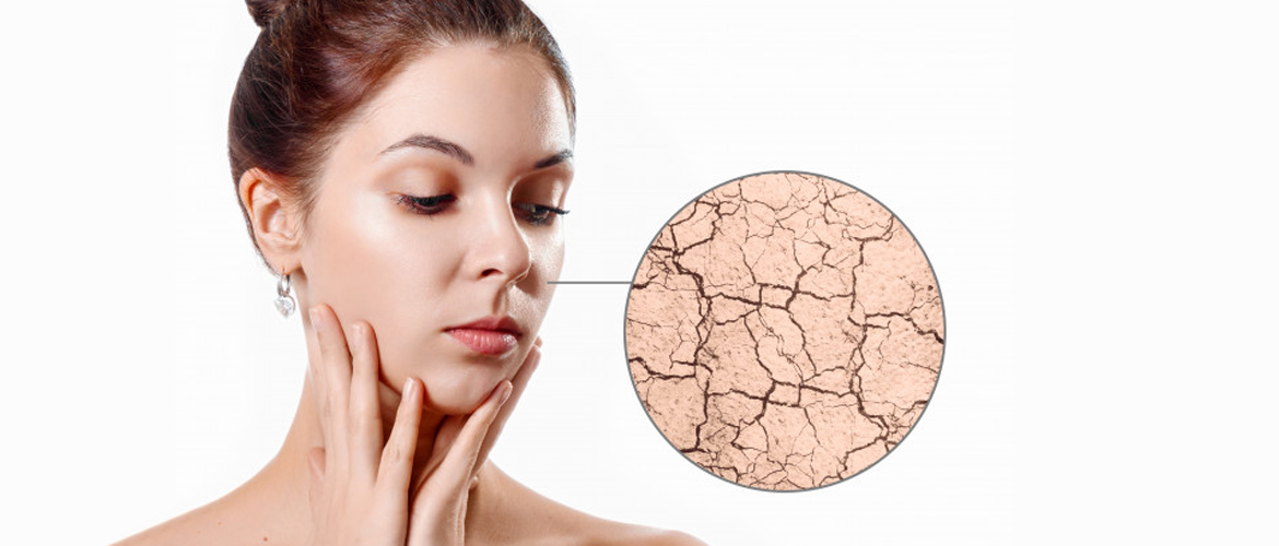 How to Deal with Dry Skin, Hair, Hands and Lips