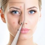 Major Six Signs of Sensitive Skin