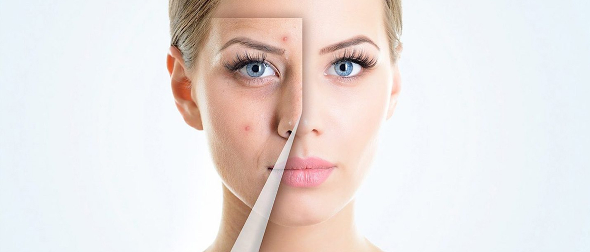 Major Six Signs of Sensitive Skin