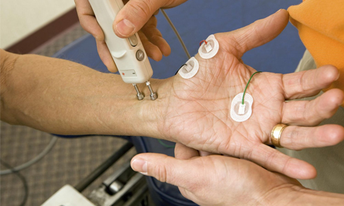 TENS for Diabetic Neuropathy