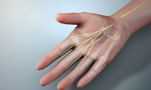 Peripheral Neuropathy - A Type of Diabetic Neuropathy