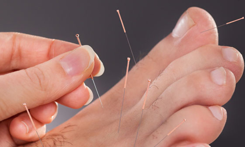 Alternative Therapies`