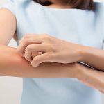 How to Treat Fungal Infection