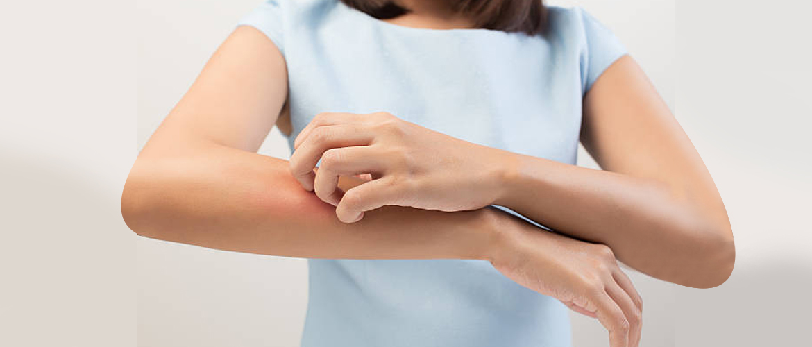 How to Treat Fungal Infection