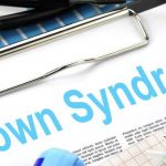 Down Syndrome Patients Are More Vulnerable to COVID 19!