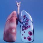 How Effective Are Immunotherapy Drugs to Treat Lung Cancer?