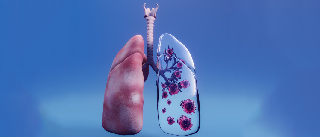 How Effective Are Immunotherapy Drugs to Treat Lung Cancer?