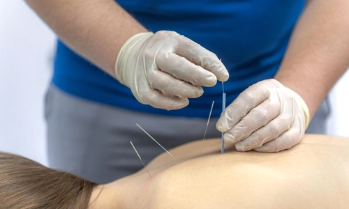 Healthcare professional assessing a woman's shoulder and collarbone