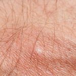 Is Spider’s Bite Harmful to Humans?