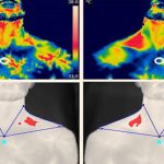 Brown Fat Produced During Flu Helps Burn Calories?