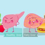 How Excess Carbs & Alcohol Can Lead To Fatty Liver!
