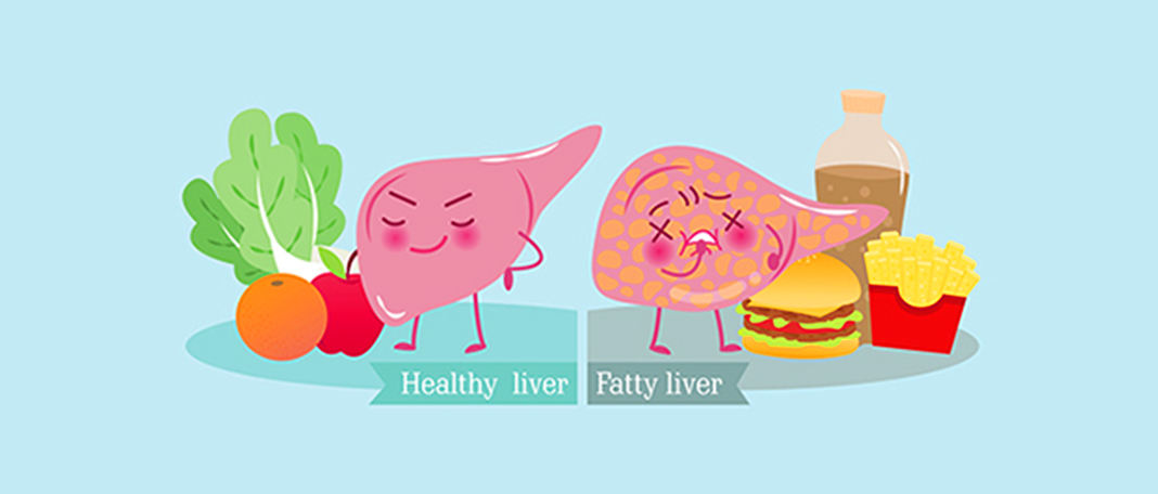 How Excess Carbs & Alcohol Can Lead To Fatty Liver!