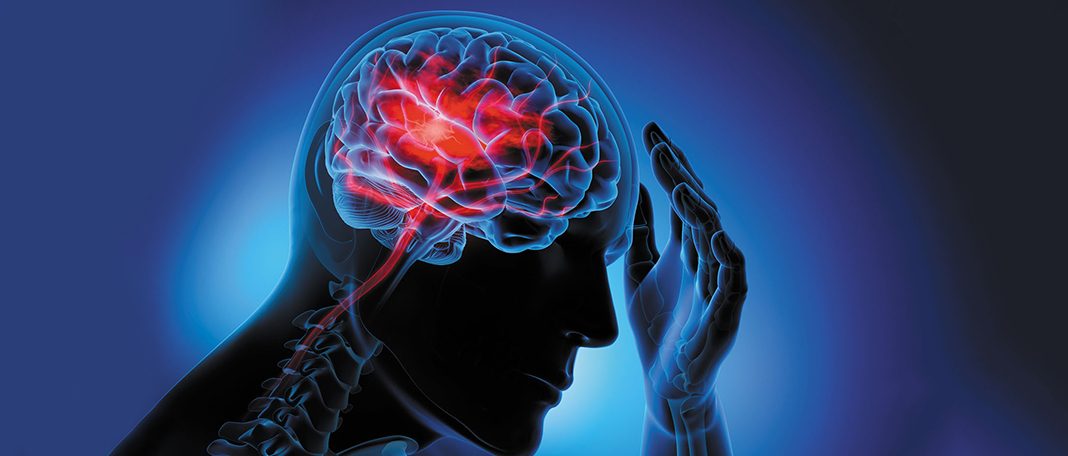The Device Identifies the Potentially Risky Ministrokes!